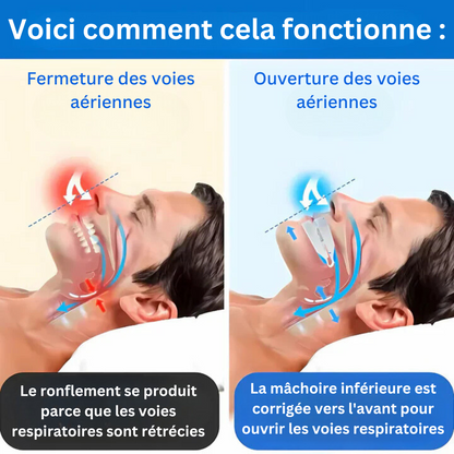 Dispositivo antironquidos SnoreFree